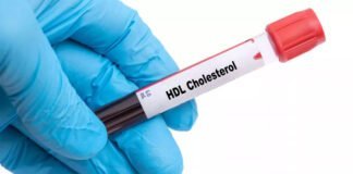 Cholestérol HDL : Votre Allié Secret pour un Cœur en Santé !