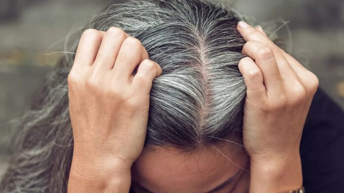 Le stress peut-il donner des cheveux blancs ?